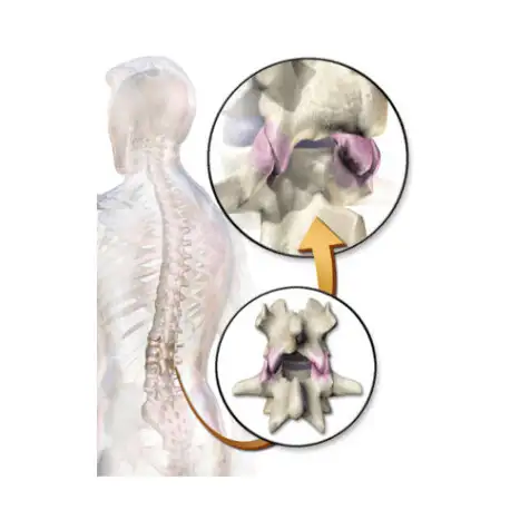 Tubo flessibile CAUTEX/FACET 995011 CAUTEX/FACET 995011